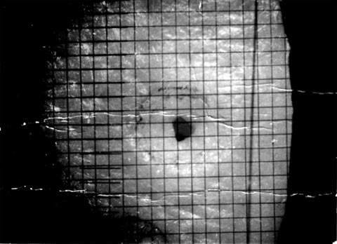 рана с нанесённой фотоспособом масштабной сеткой