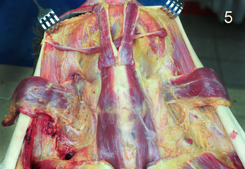 Препаровка Musculus sternohyoideus Препаровка Musculus sternohyoideus